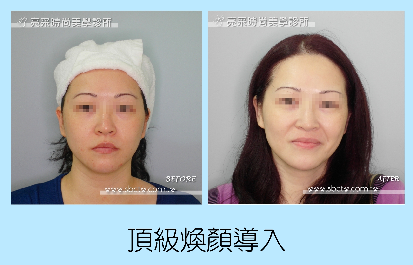 頂級煥顏導入
