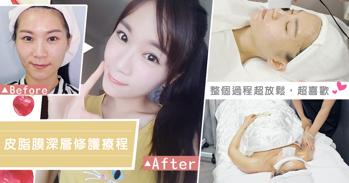 ★FB分享-皮脂膜深層修復★