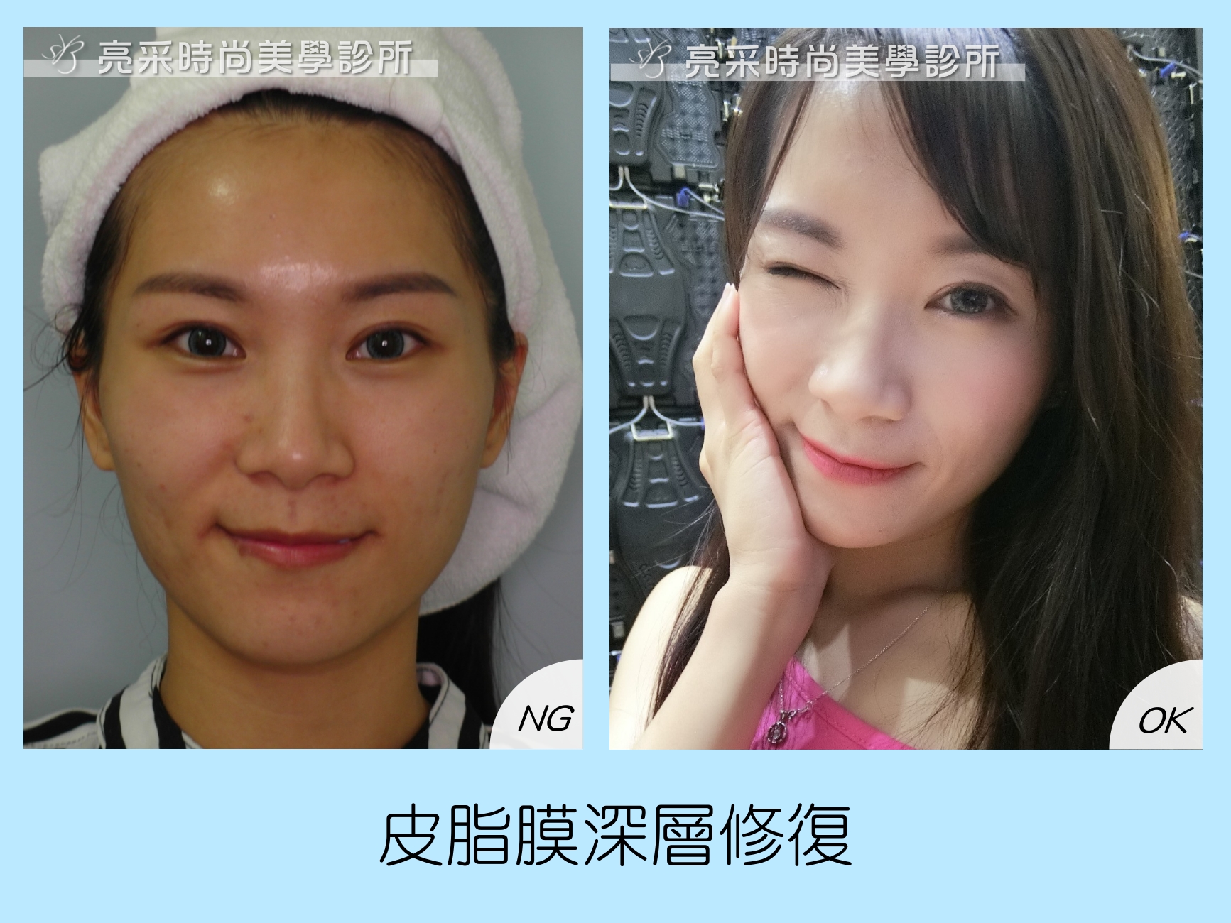 皮脂膜深層修復